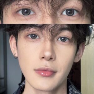 Contact lens (Anchor development)